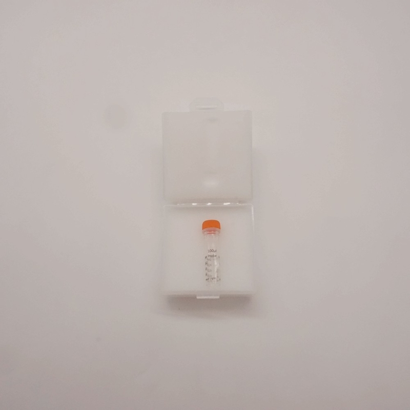 ヒトMYC/IGH遺伝子異常検出用MYC/IGHデュアルカラープローブ